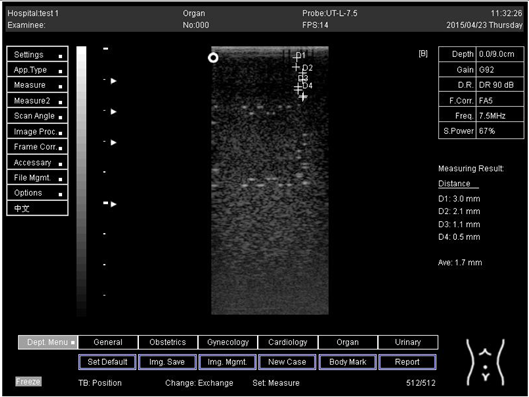 Biomimetics 07 00130 i017