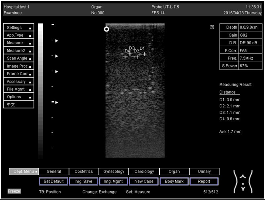 Biomimetics 07 00130 i018