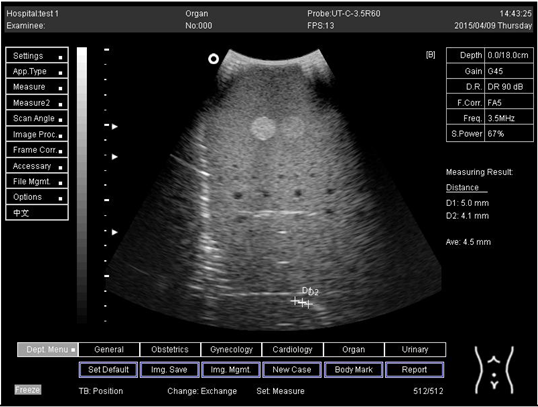 Biomimetics 07 00130 i020