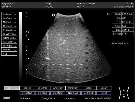 Biomimetics 07 00130 i033