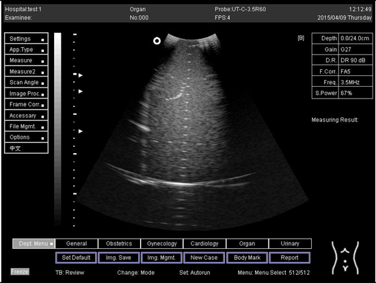 Biomimetics 07 00130 i034