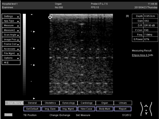 Biomimetics 07 00130 i037