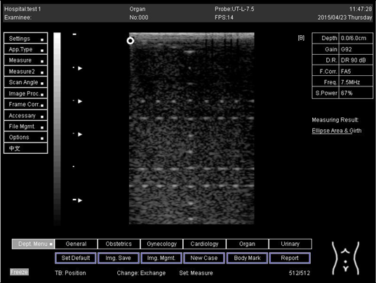 Biomimetics 07 00130 i038