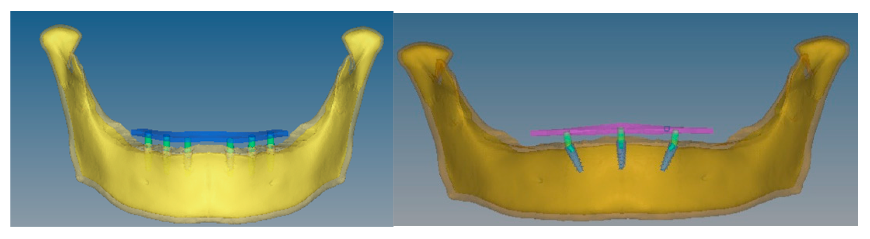 Biomimetics 08 00015 g001 Biomimetics 08 00015 g001