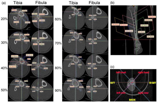 Development of a Bionic Tube with High Bending-Stiffness Properties ...