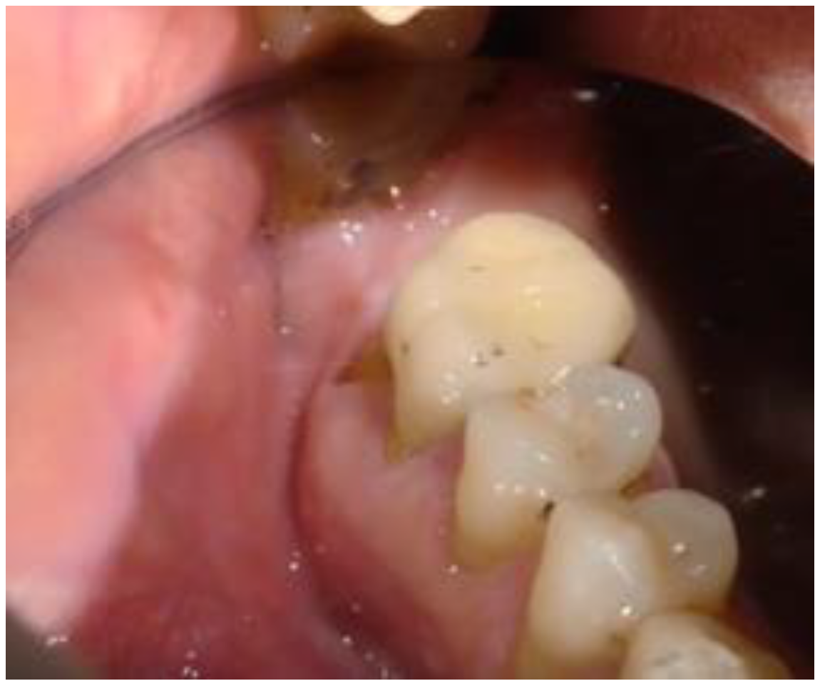 Biomimetics 08 00106 g001 Biomimetics 08 00106 g001