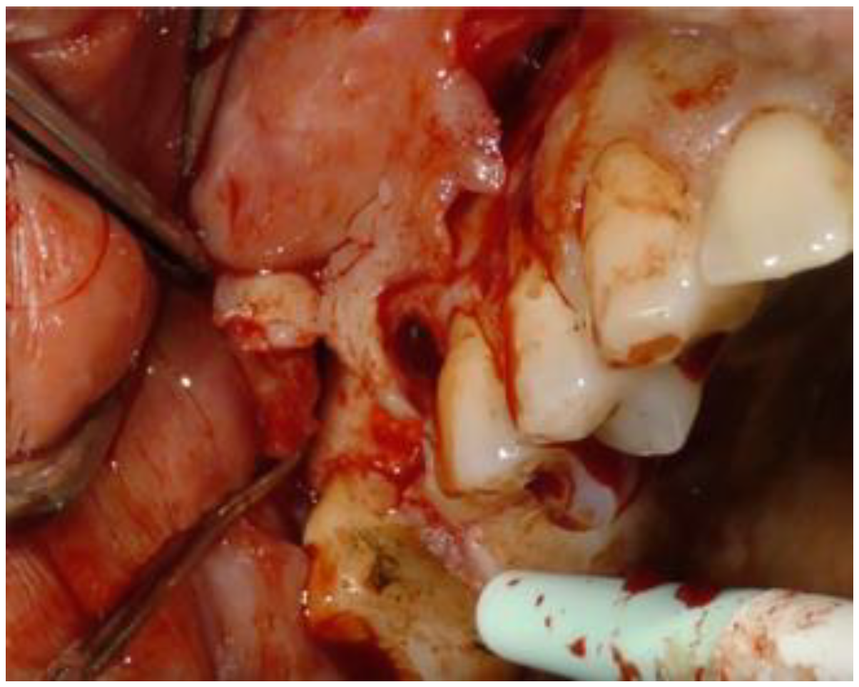 Biomimetics 08 00106 g002 Biomimetics 08 00106 g002