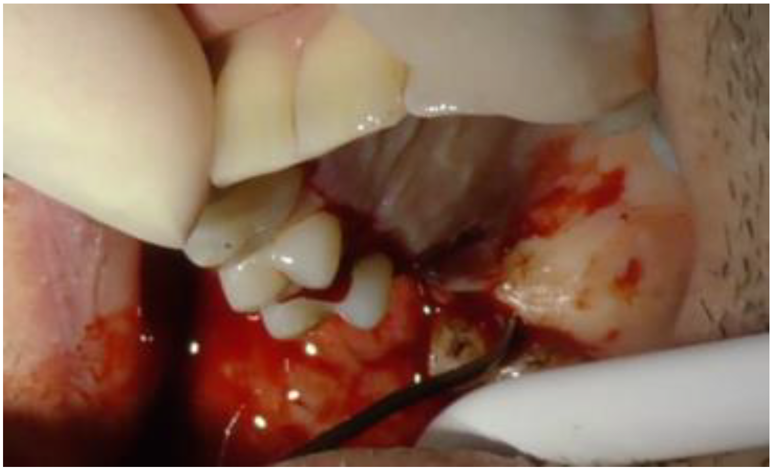 Biomimetics 08 00106 g003 Biomimetics 08 00106 g003