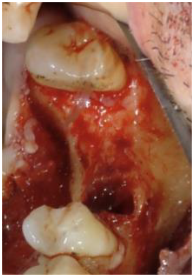 Biomimetics 08 00106 g004 Biomimetics 08 00106 g004