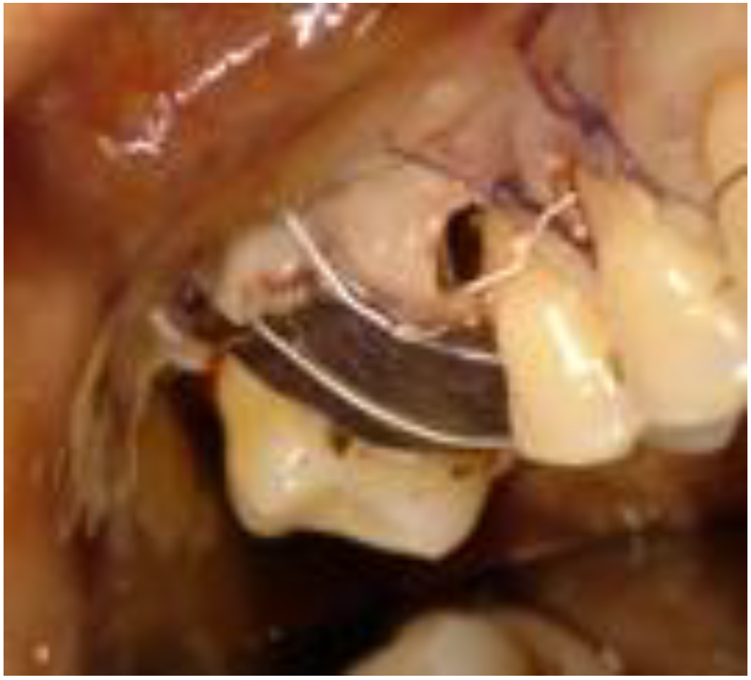 Biomimetics 08 00106 g007 Biomimetics 08 00106 g007