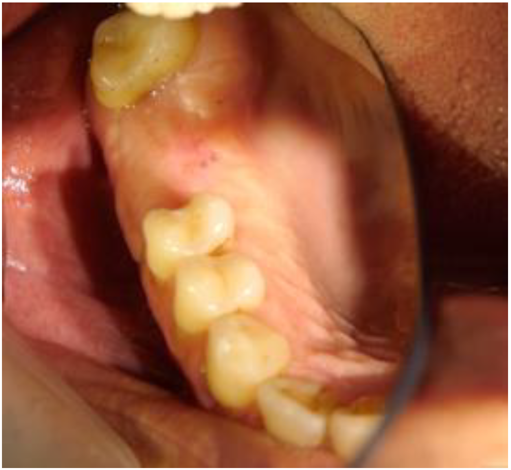 Biomimetics 08 00106 g010 Biomimetics 08 00106 g010