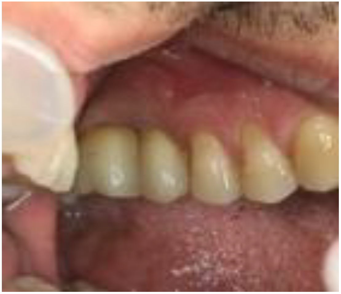 Biomimetics 08 00106 g012 Biomimetics 08 00106 g012