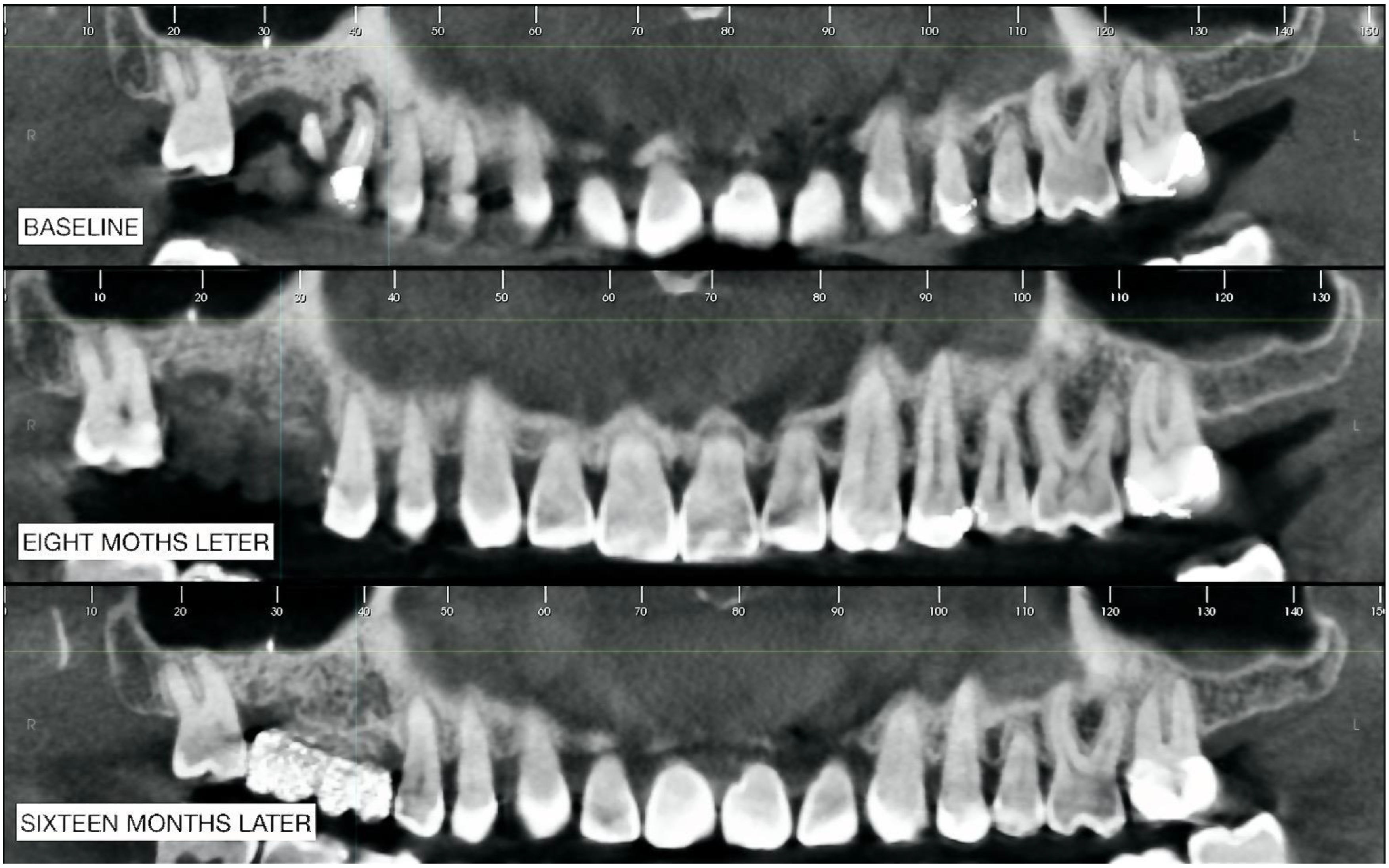 Biomimetics 08 00106 g013 Biomimetics 08 00106 g013