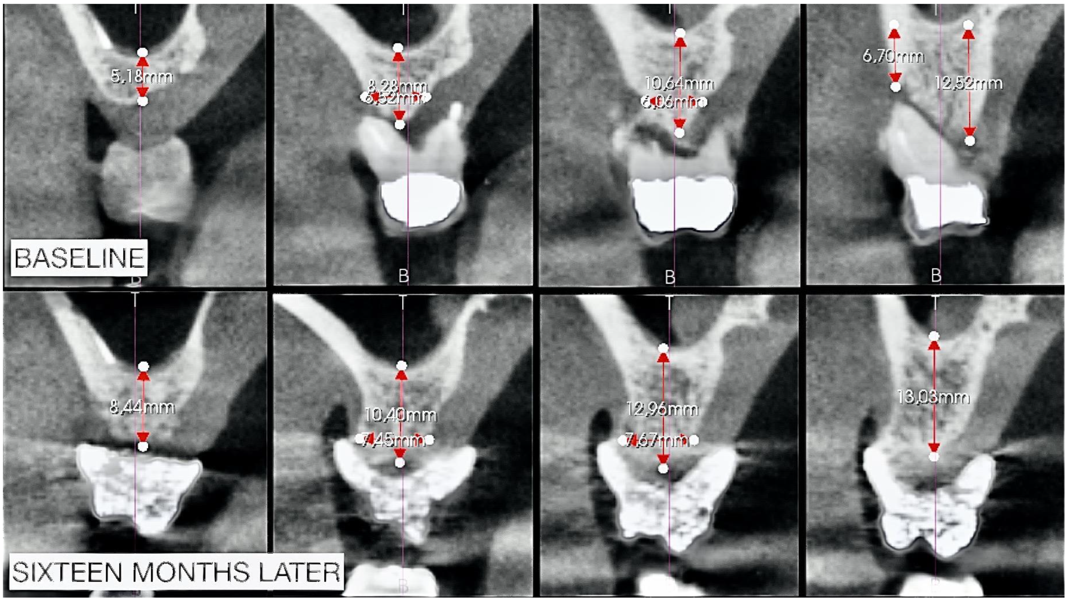 Biomimetics 08 00106 g014 Biomimetics 08 00106 g014