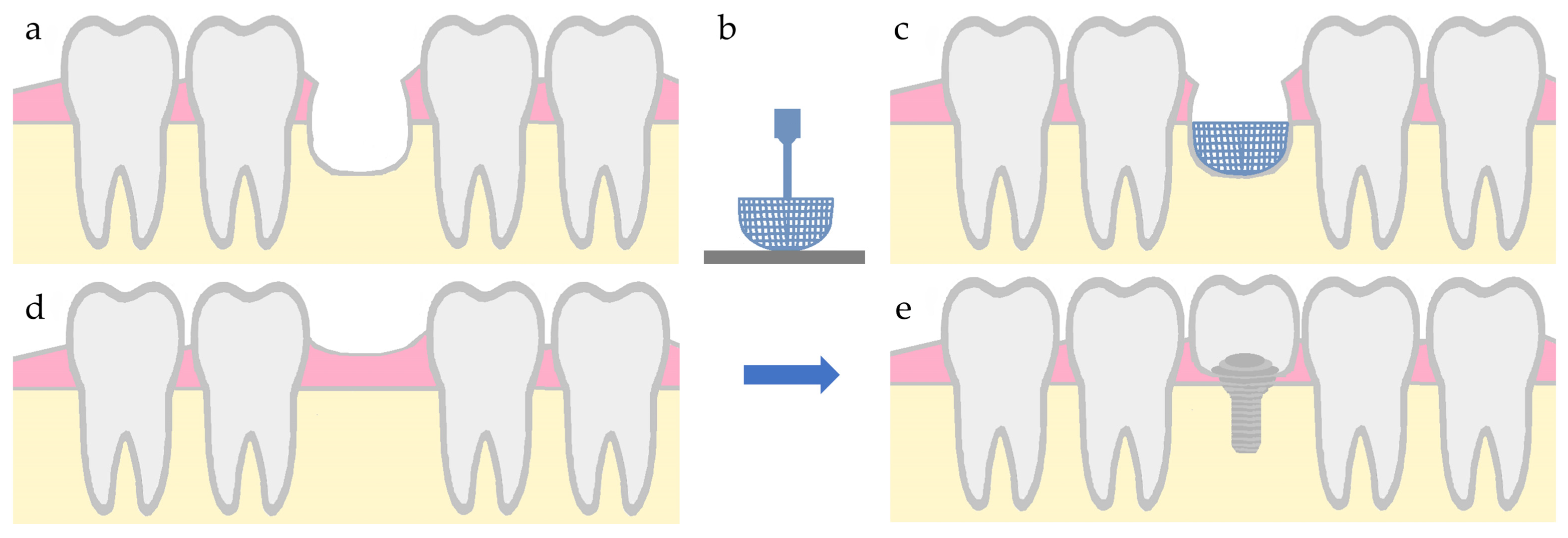 Biomimetics 09 00153 g005 Biomimetics 09 00153 g005