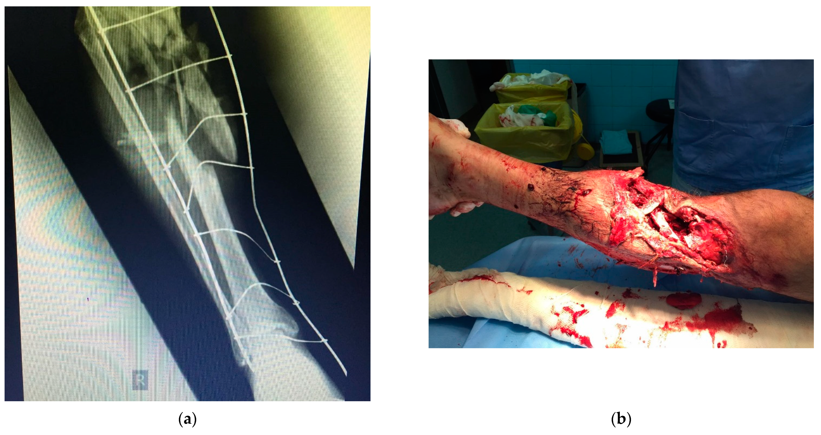 Biomimetics 09 00169 g006