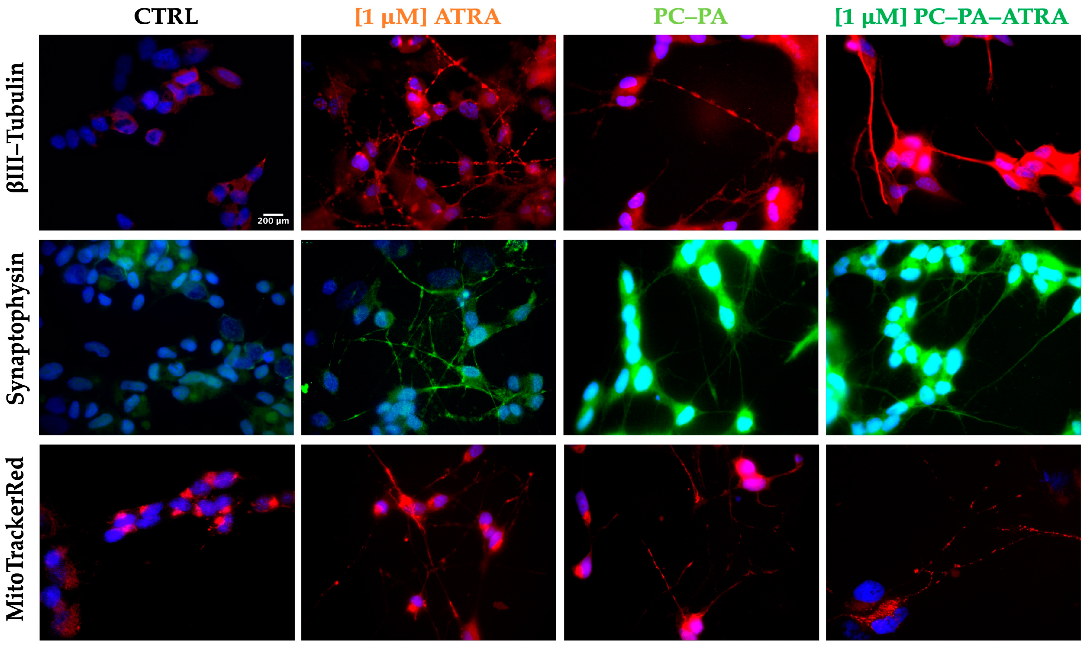 Biomimetics 09 00257 g005