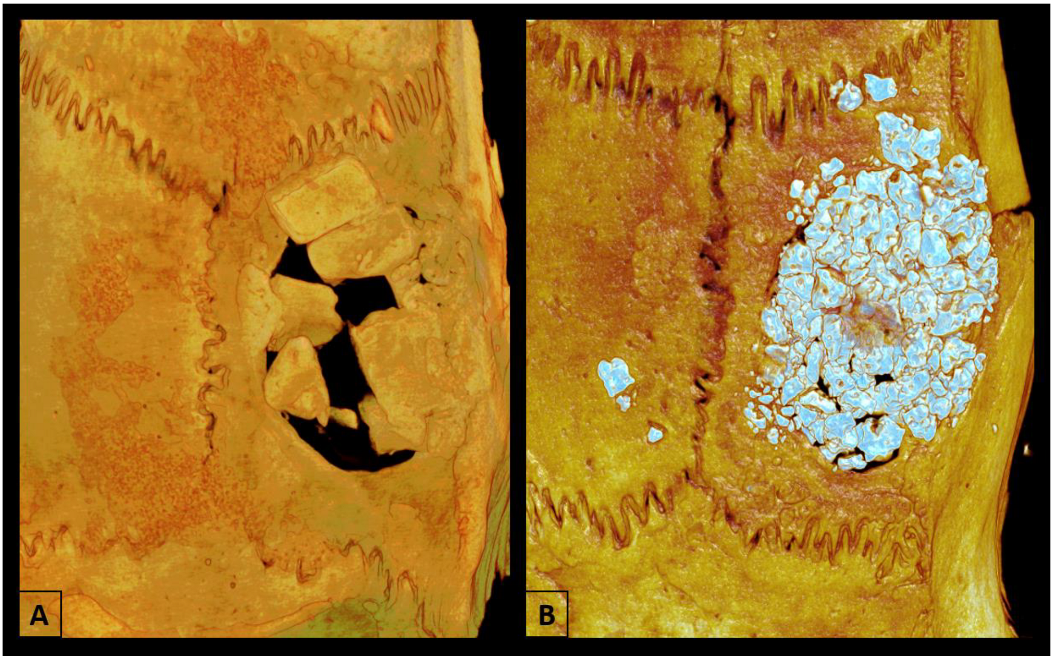 Biomimetics 09 00284 g002 Biomimetics 09 00284 g002