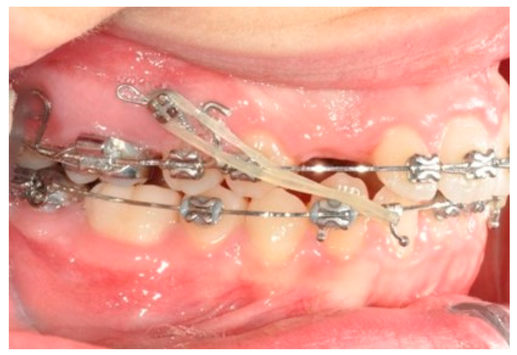 Biomimetics 09 00305 g006