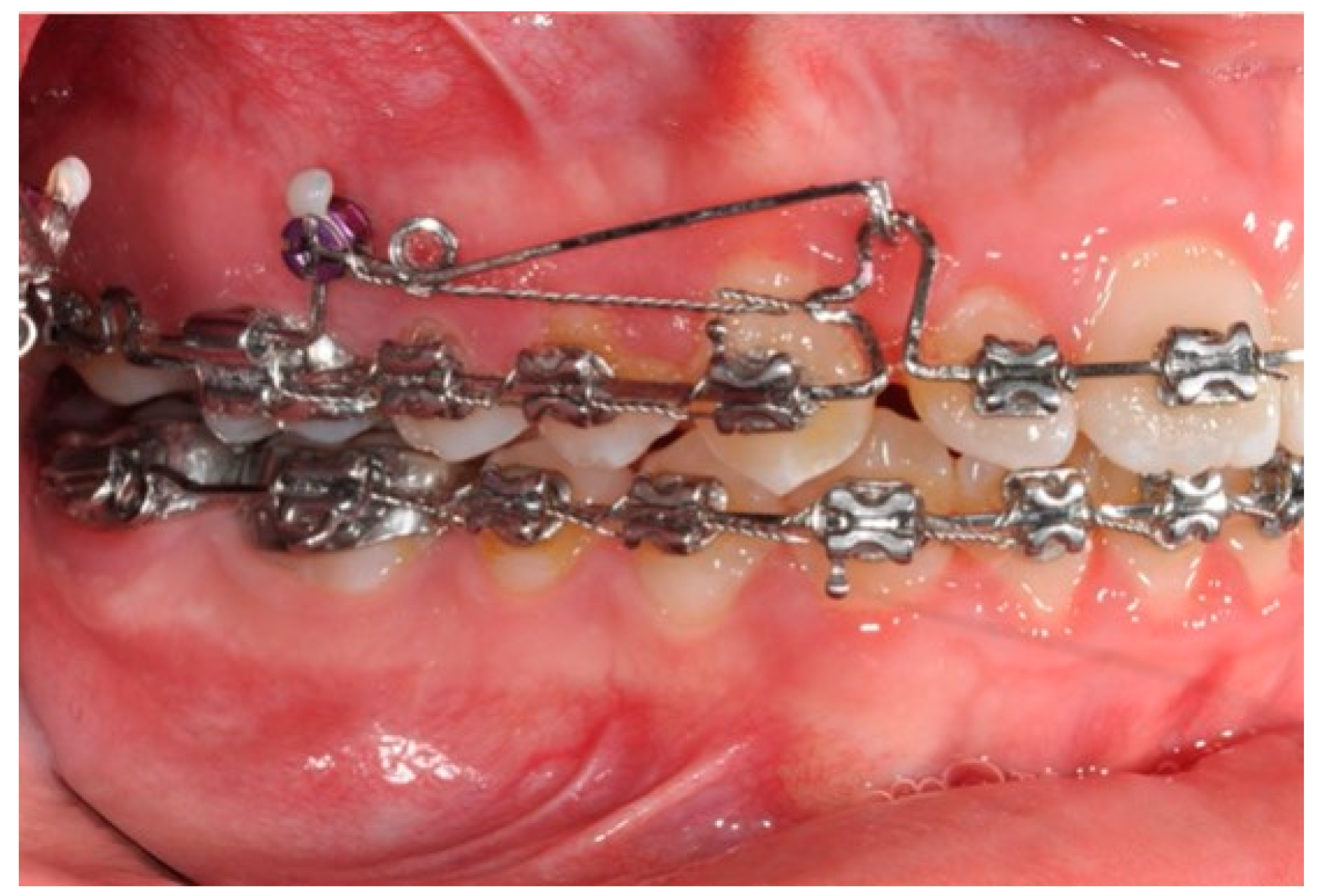 Biomimetics 09 00305 g009