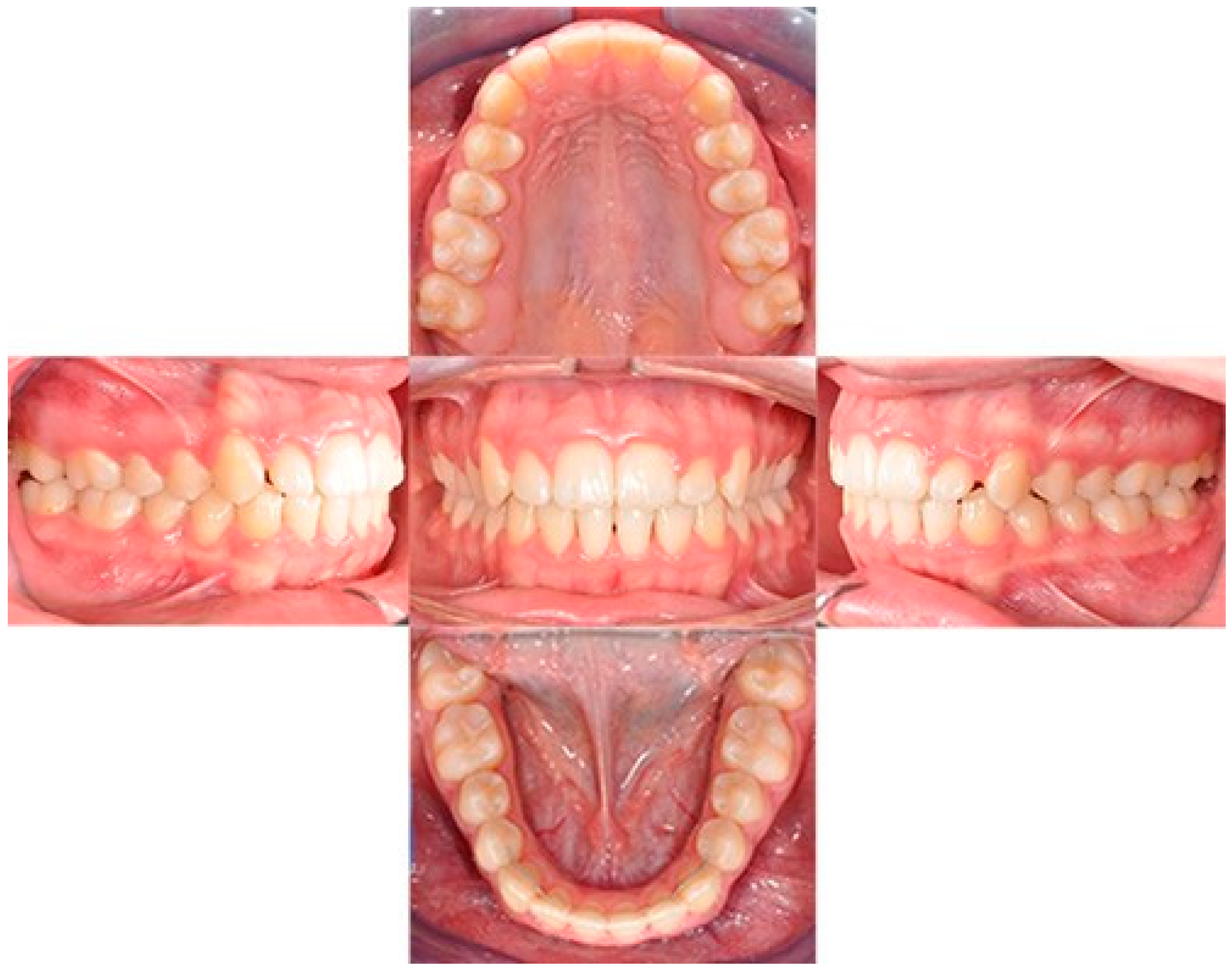 Biomimetics 09 00305 g011