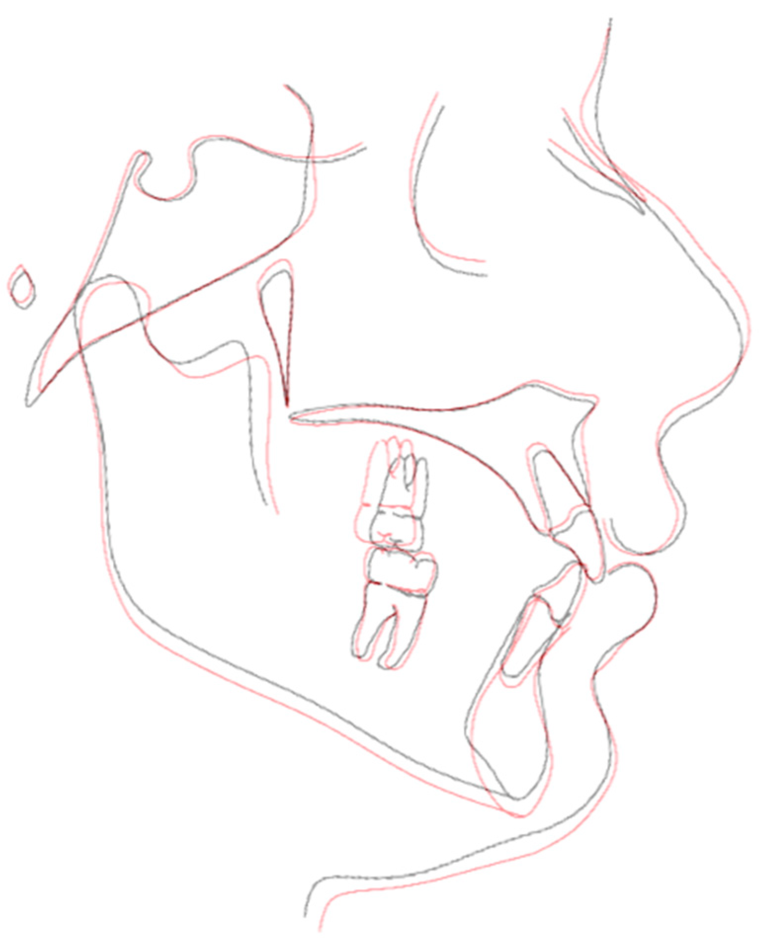 Biomimetics 09 00305 g013