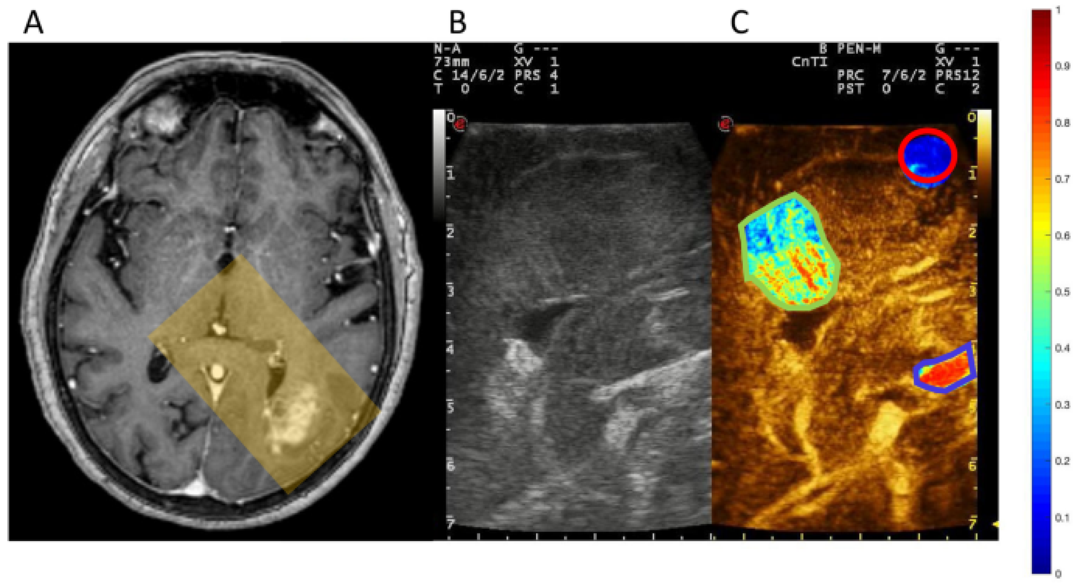 Biomimetics 09 00645 g003 Biomimetics 09 00645 g003
