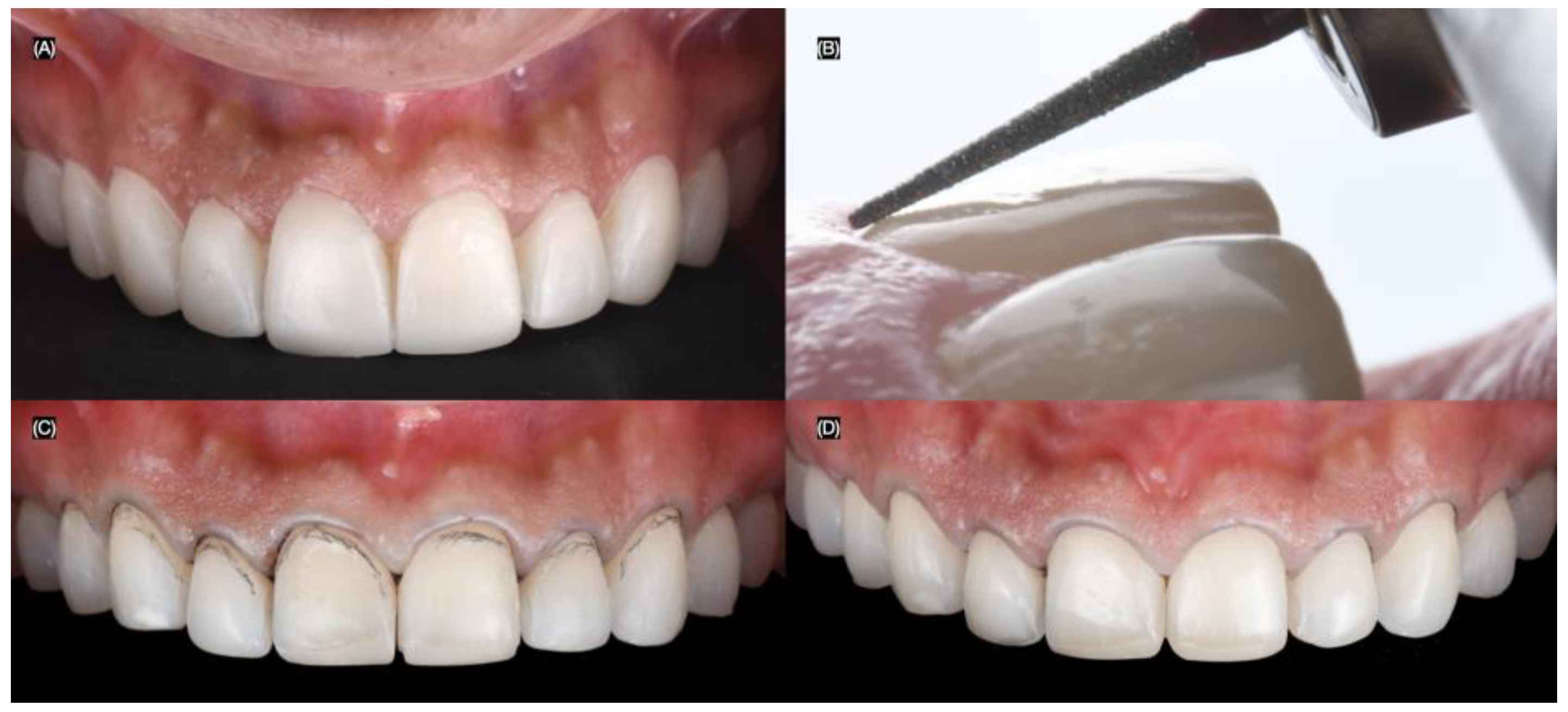 Biomimetics 10 00188 g004