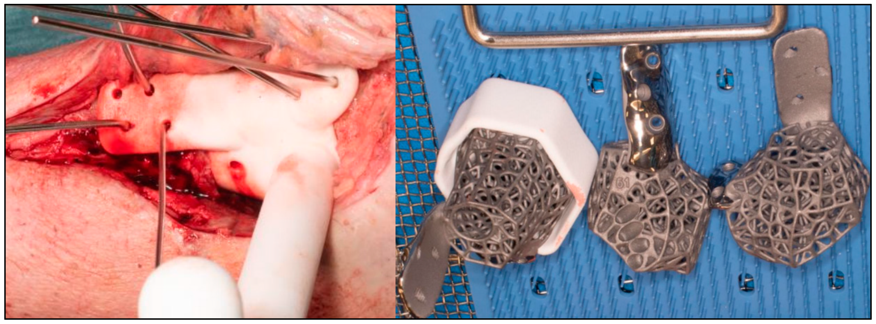 Biomimetics 10 00269 g006