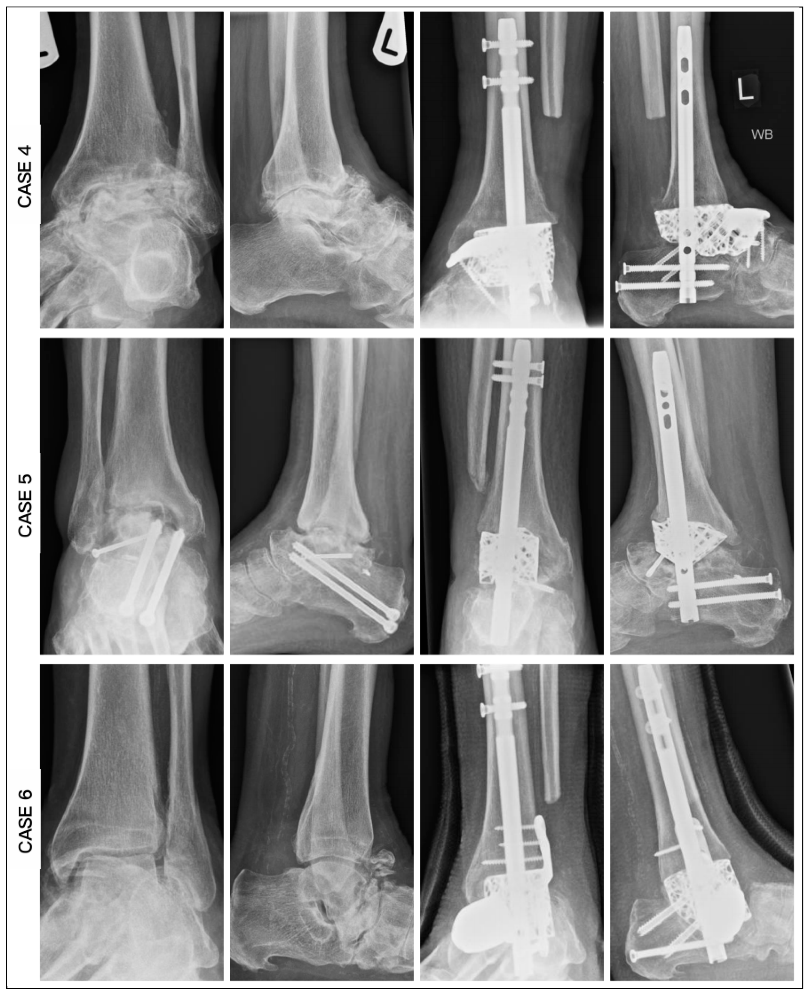 Biomimetics 10 00269 g011
