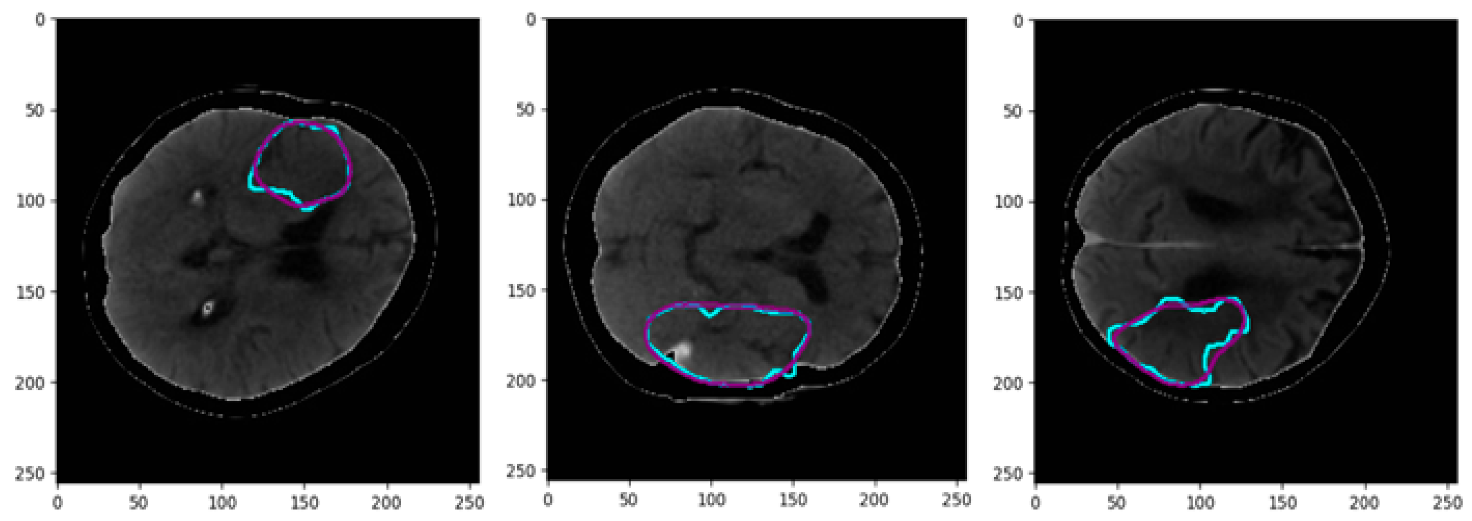 Biomimetics 10 00509 g011a