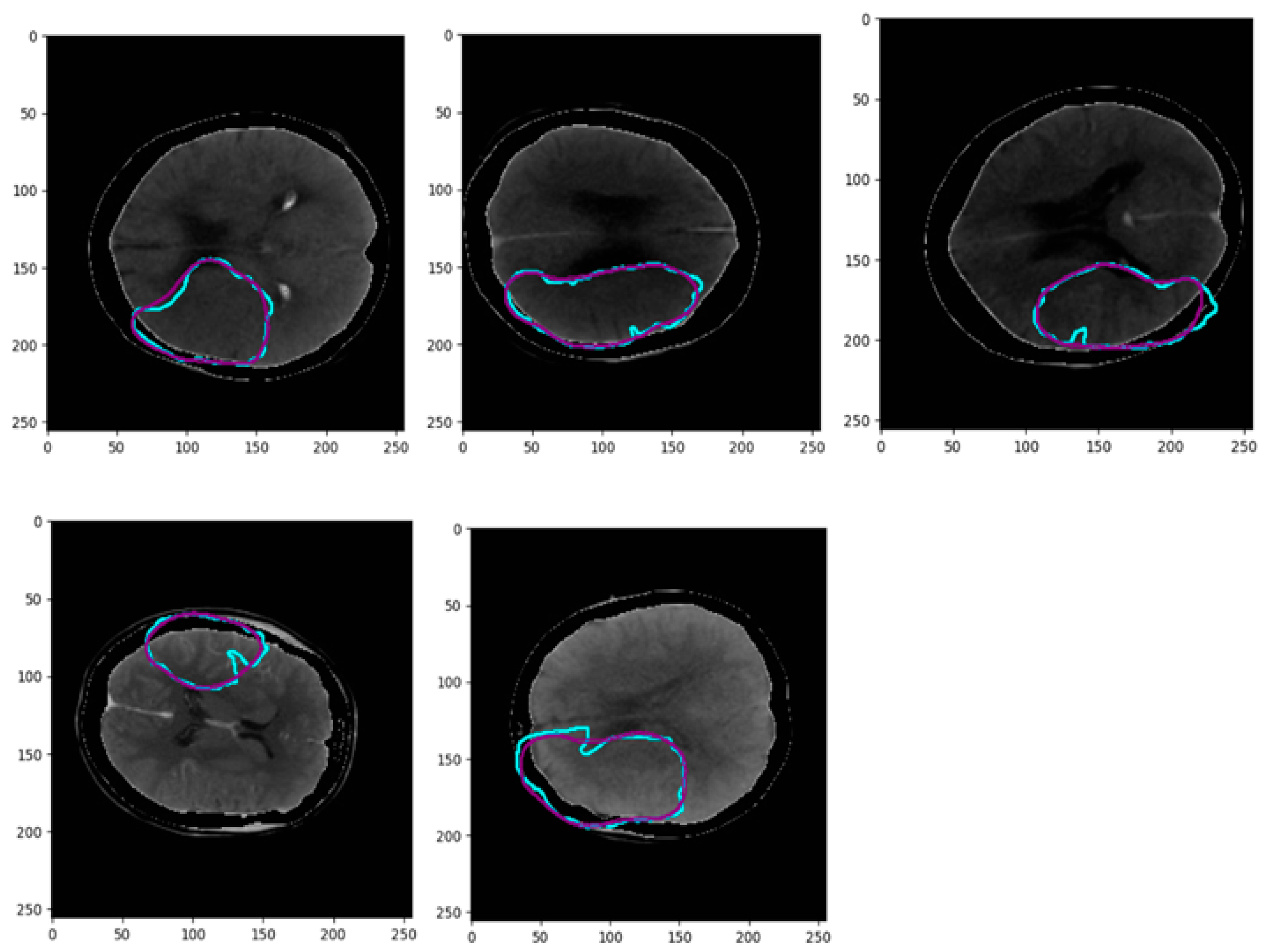 Biomimetics 10 00509 g011b