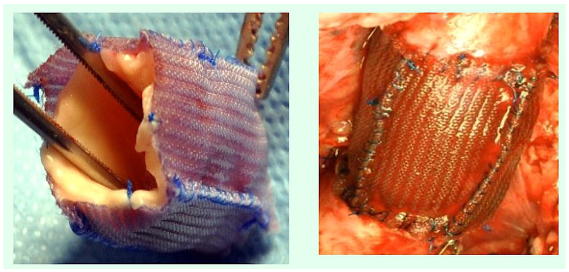 Biomimetics 10 00590 g001 Biomimetics 10 00590 g001