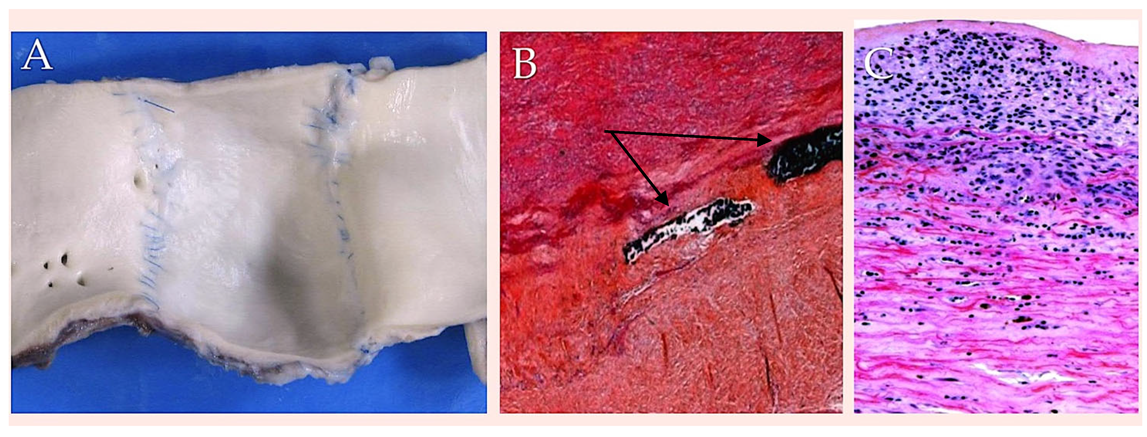 Biomimetics 10 00590 g002 Biomimetics 10 00590 g002