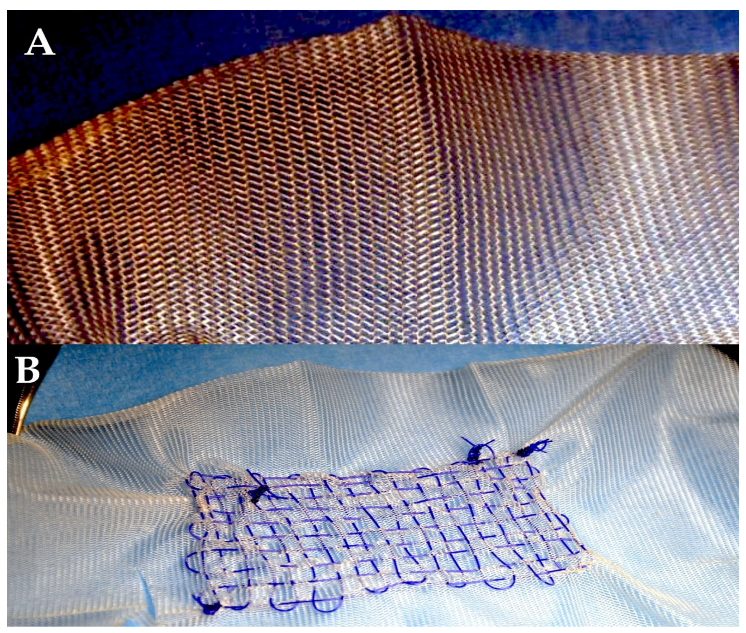 Biomimetics 10 00590 g004 Biomimetics 10 00590 g004