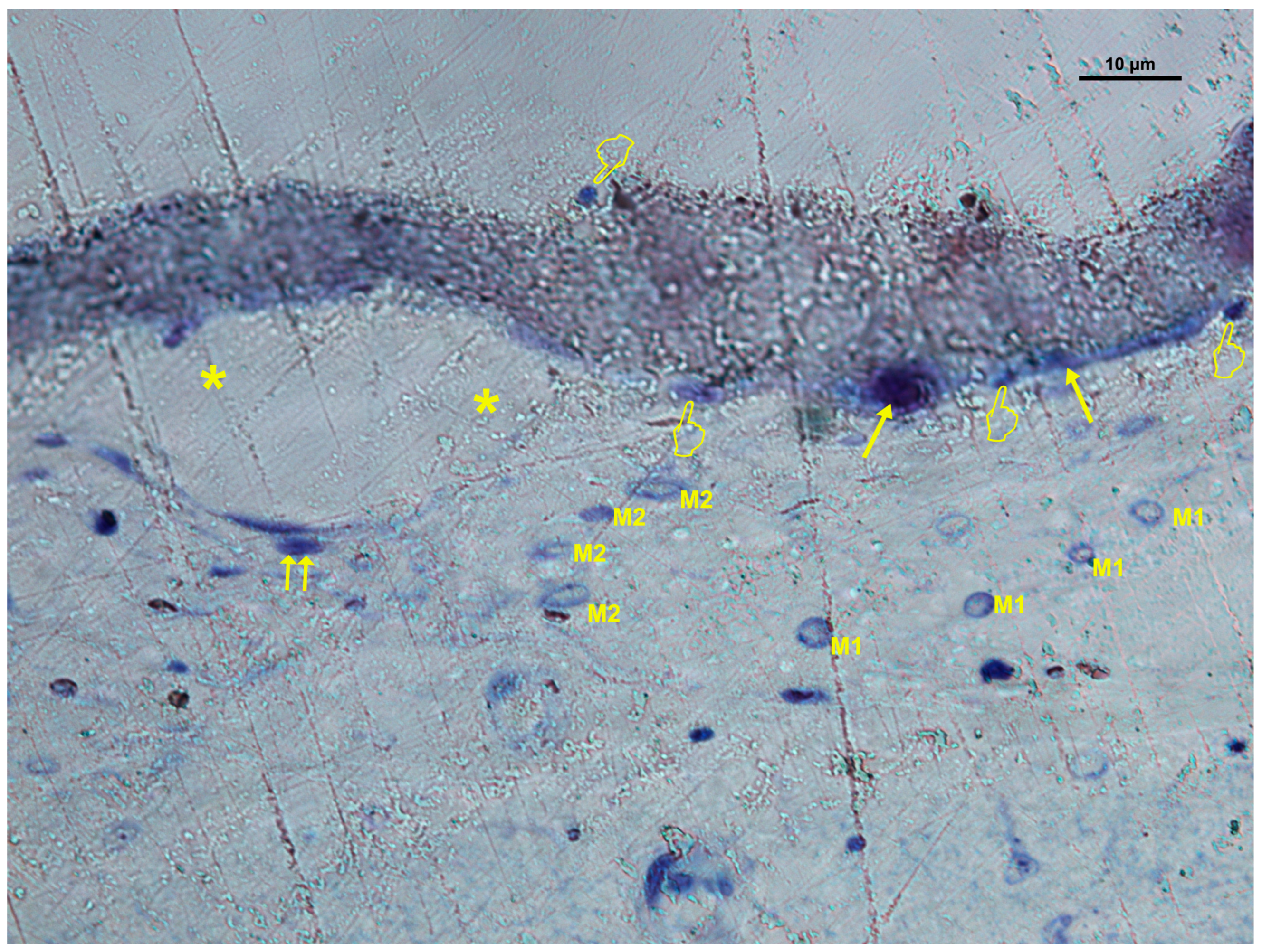 Biomimetics 10 00726 g010 Biomimetics 10 00726 g010