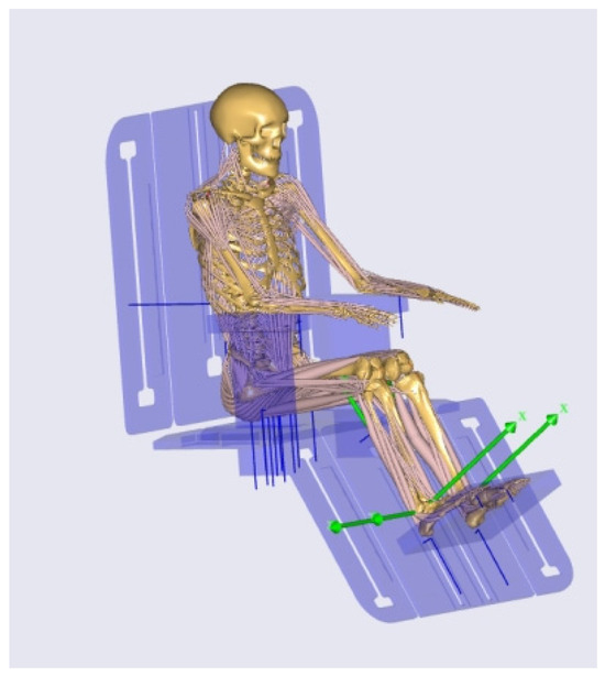Design Methodology for a Backrest-Lifting Nursing Bed Based on