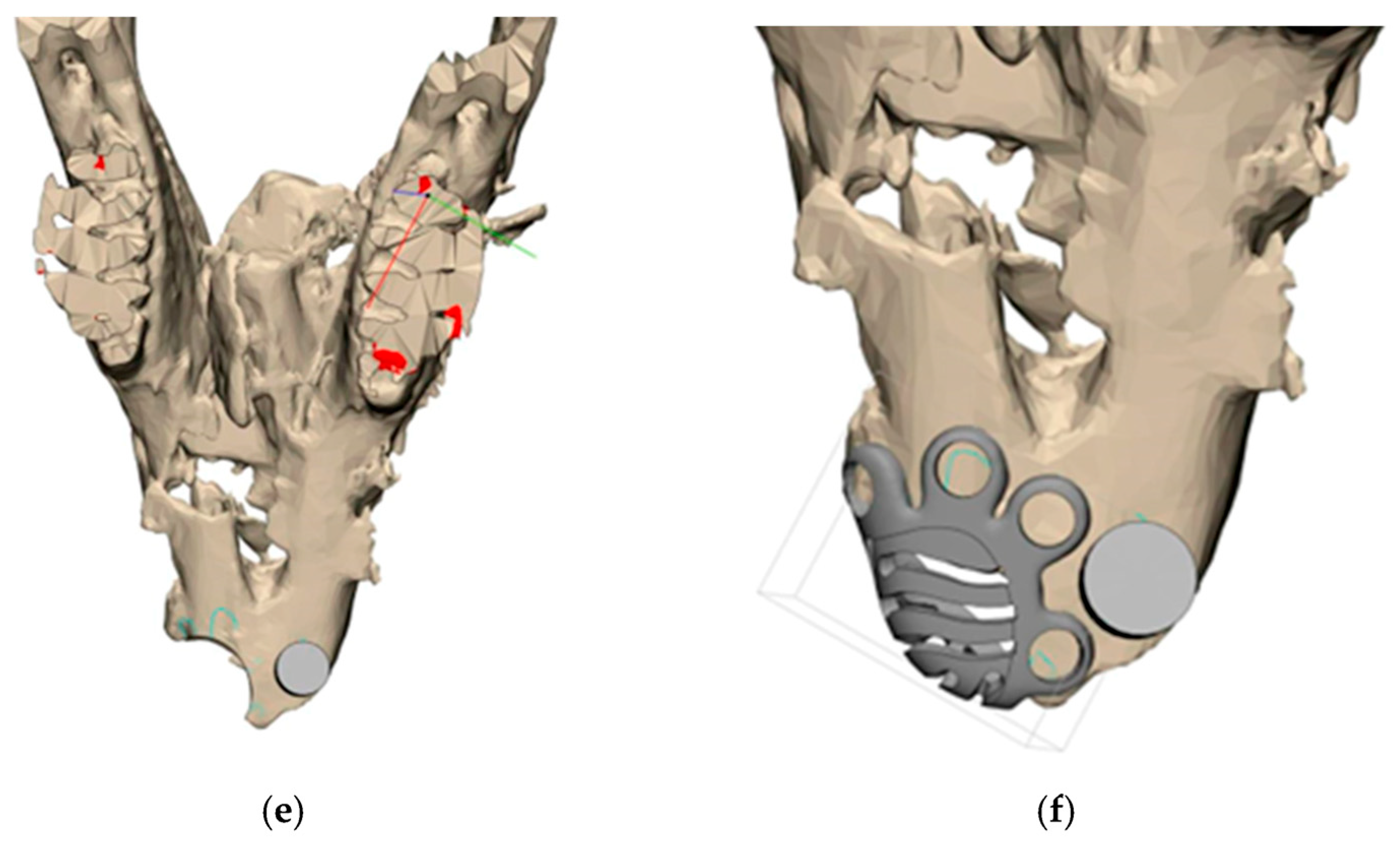 Biomimetics 11 00091 g003b
