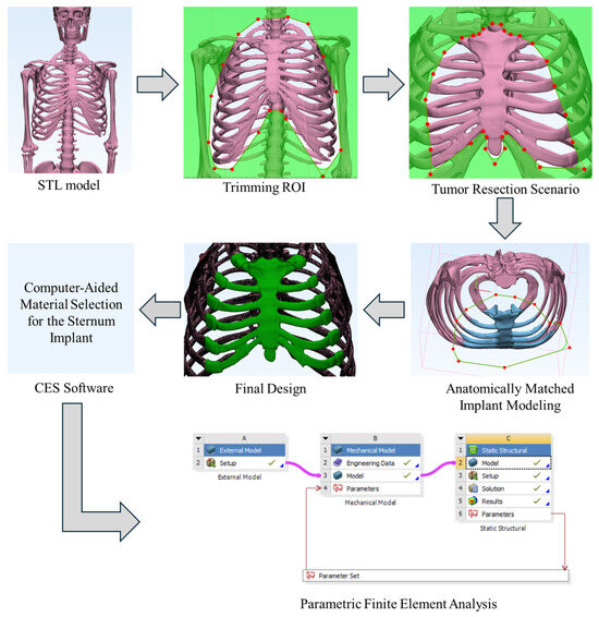 Bionic Surgery Flowchart Bioinspired Sternal Implant Design for Generic Anatomical ...