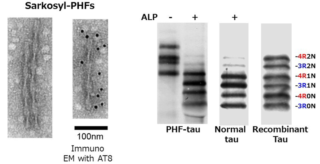 Molecular Mechanisms in the Pathogenesis of Alzheimer's