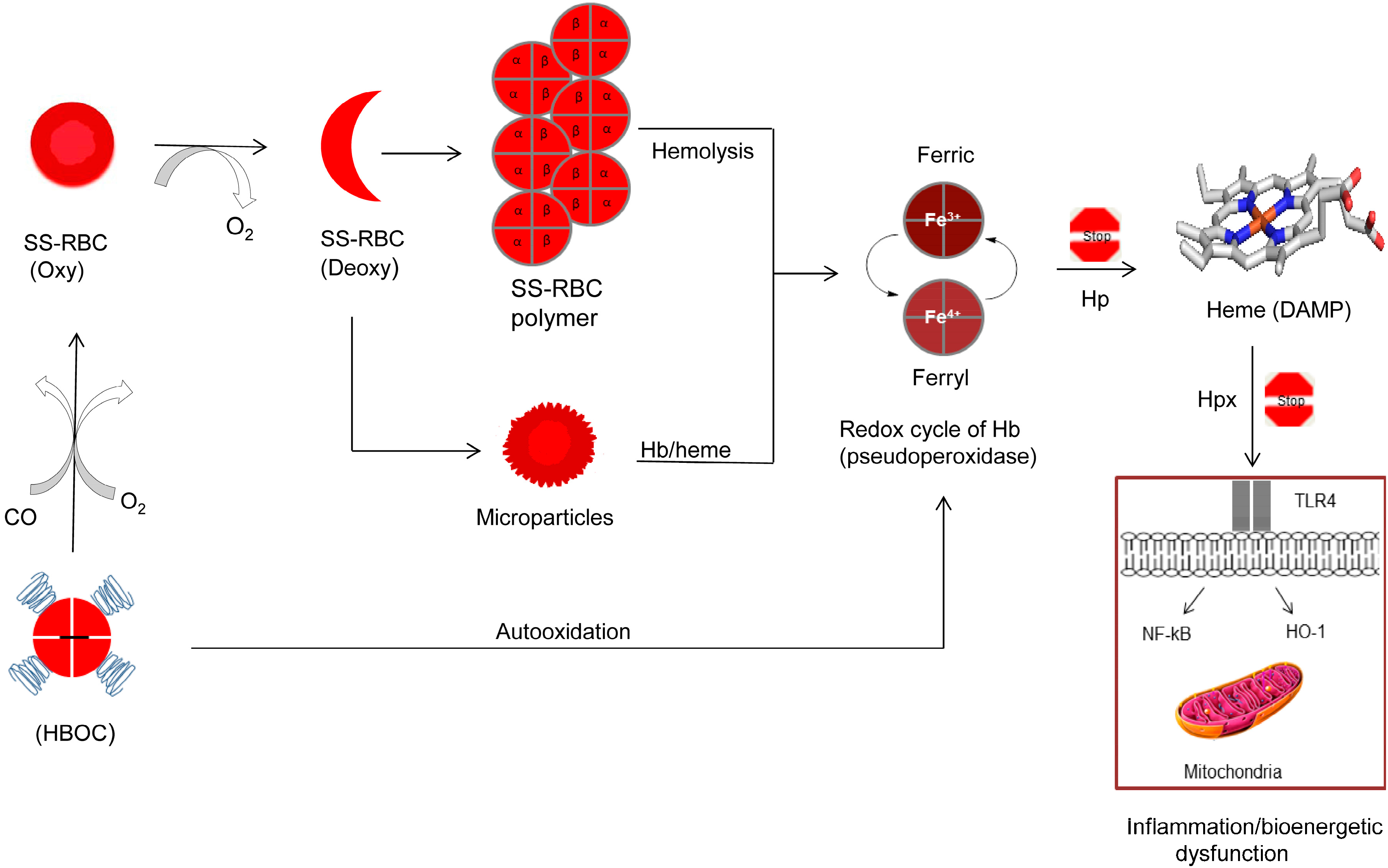 Laboratory Evaluation of Sickle Cell Disease in the ED — Taming