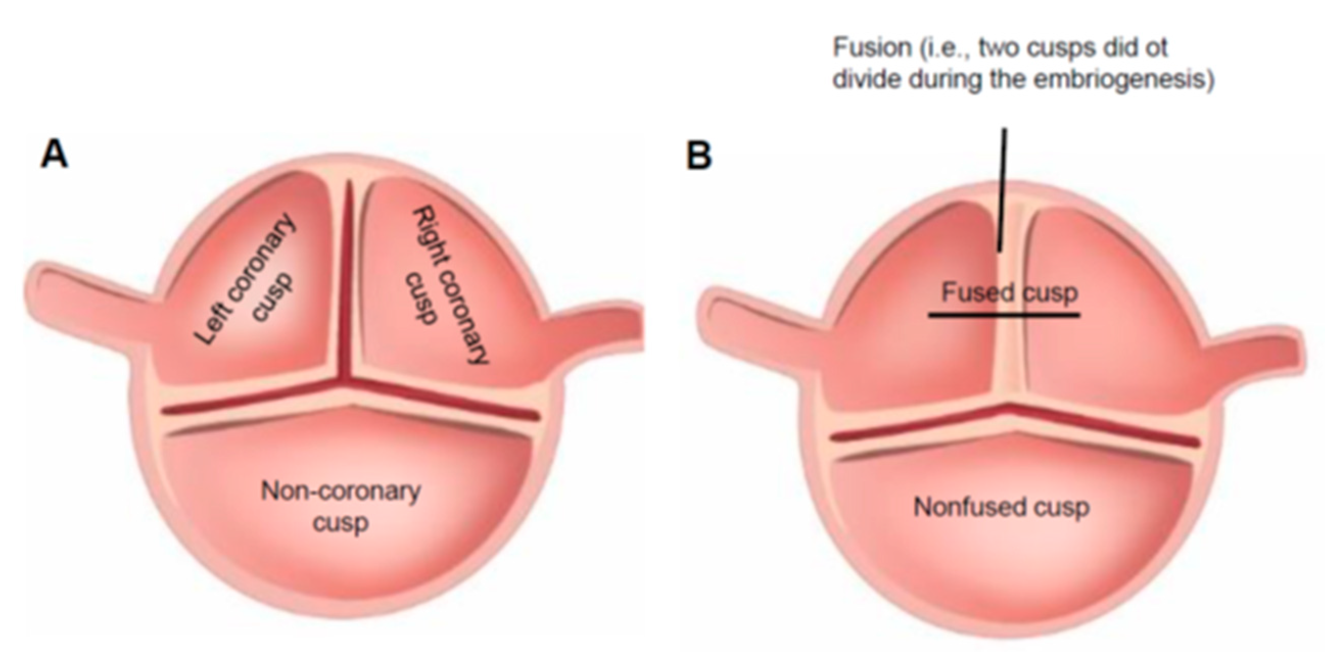 Biomolecules Free Full Text Novel Approaches For Bav Aortopathy