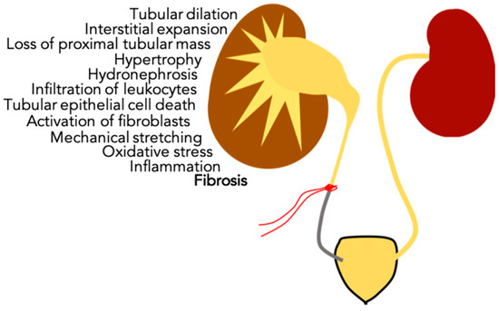 prostatitis meaning