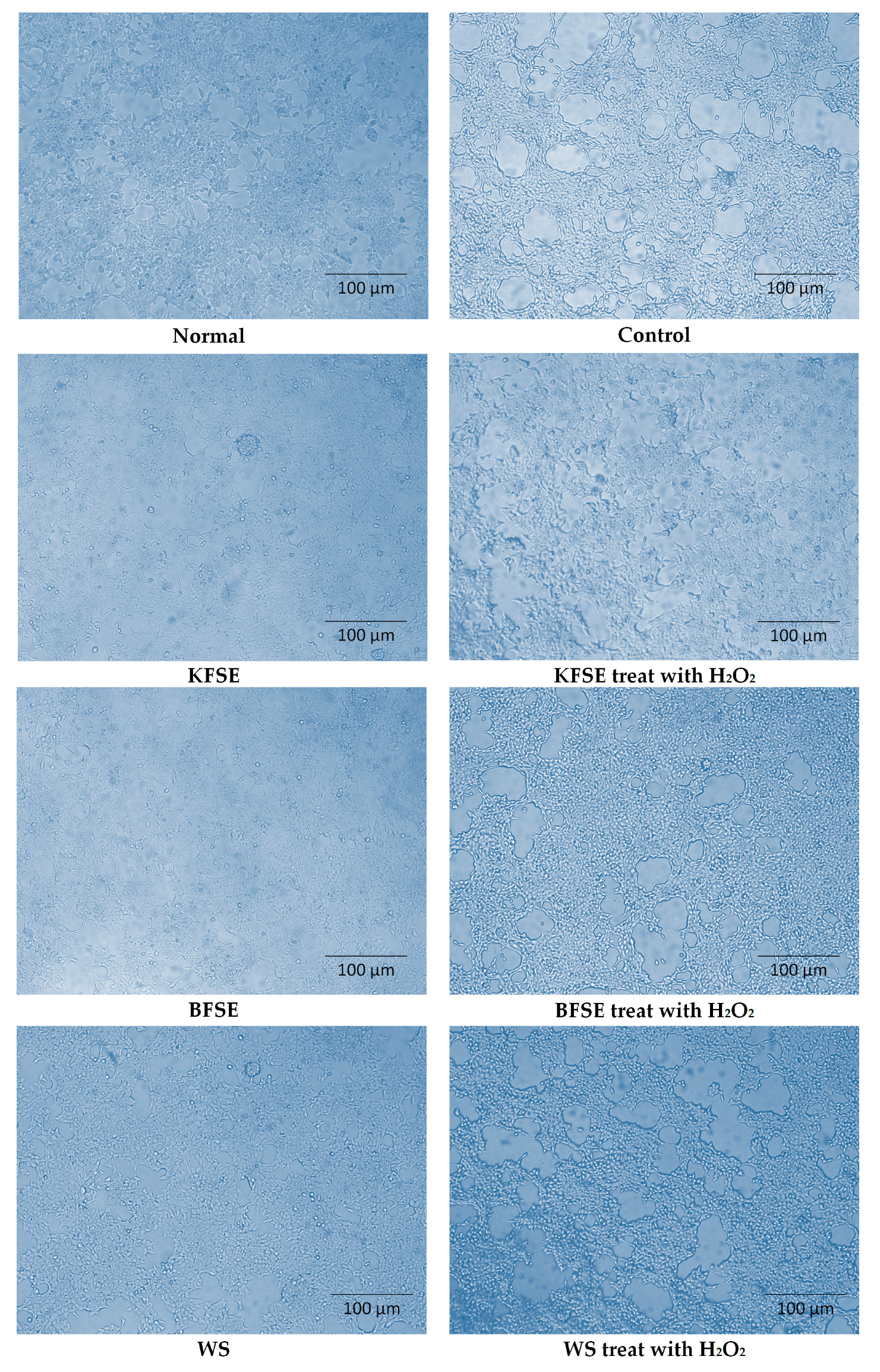 Biomolecules Free Full Text Exploring The Antioxidant Effects And Periodic Regulation Of Cancer Cells By Polyphenols Produced By The Fermentation Of Grape Skin By Lactobacillus Plantarum Kfy02 Html