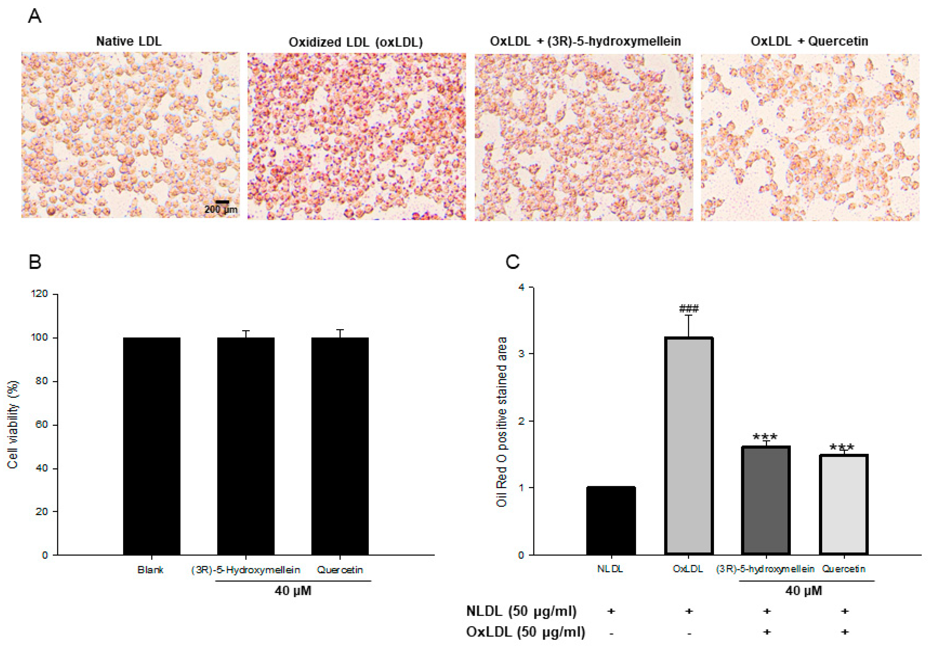 Biomolecules Free Full Text Anti Atherosclerotic Activity Of 3r 5 Hydroxymellein From An Endophytic Fungus Neofusicoccum Parvum Js 0968 Derived From Vitex Rotundifolia Through The Inhibition Of Lipoproteins Oxidation And Foam Cell Formation Html