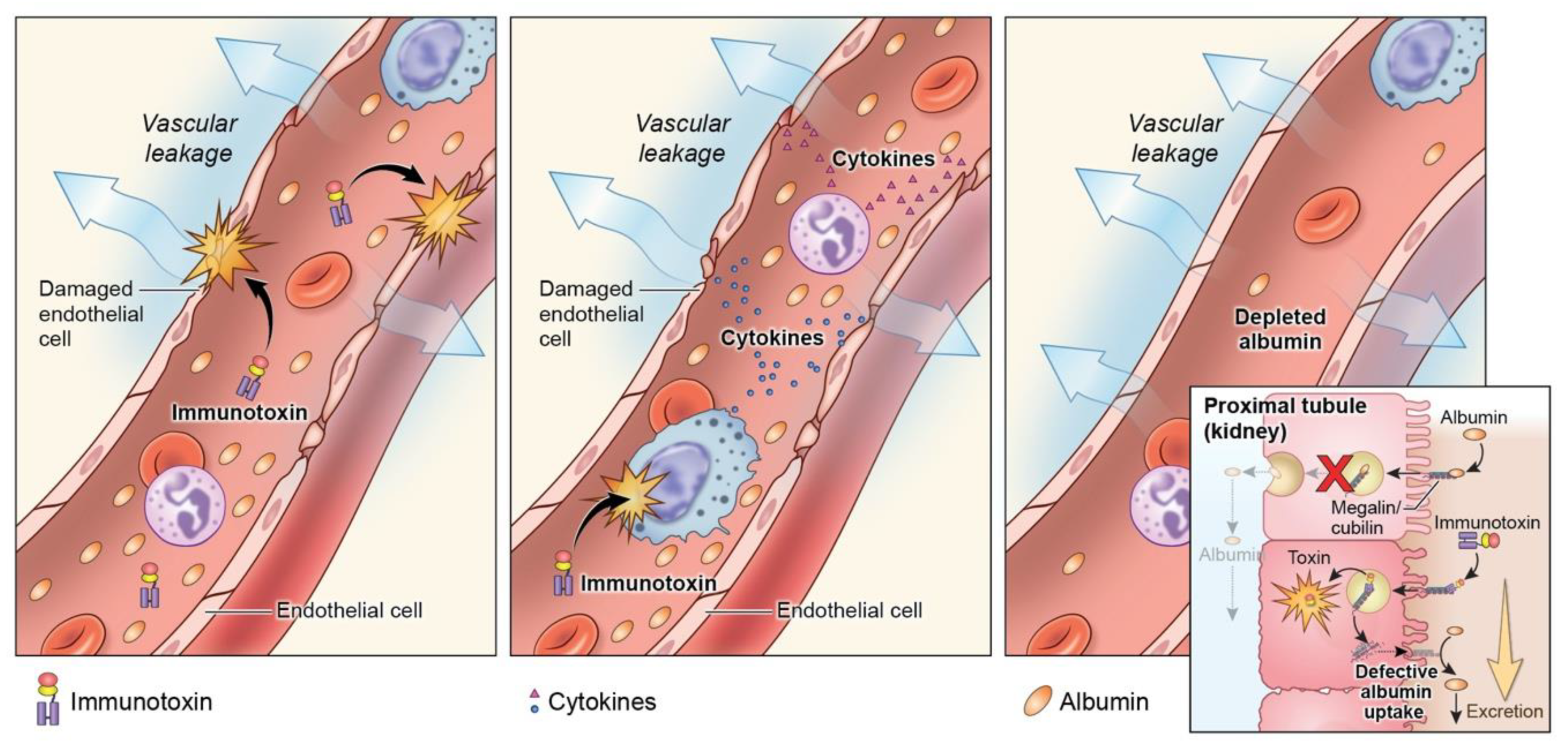 mesothelioma cases per year uk