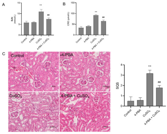 Biomolecules | Special Issue : Endoplasmic Reticulum Stress in Diseases