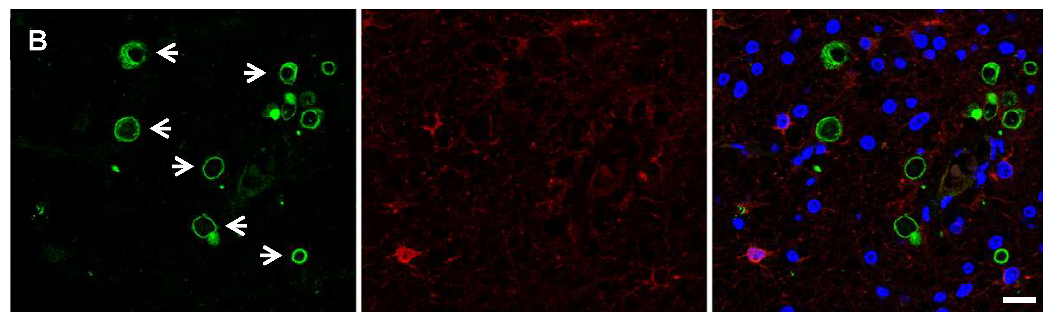 Biomolecules 10 01520 g004b Biomolecules 10 01520 g004b