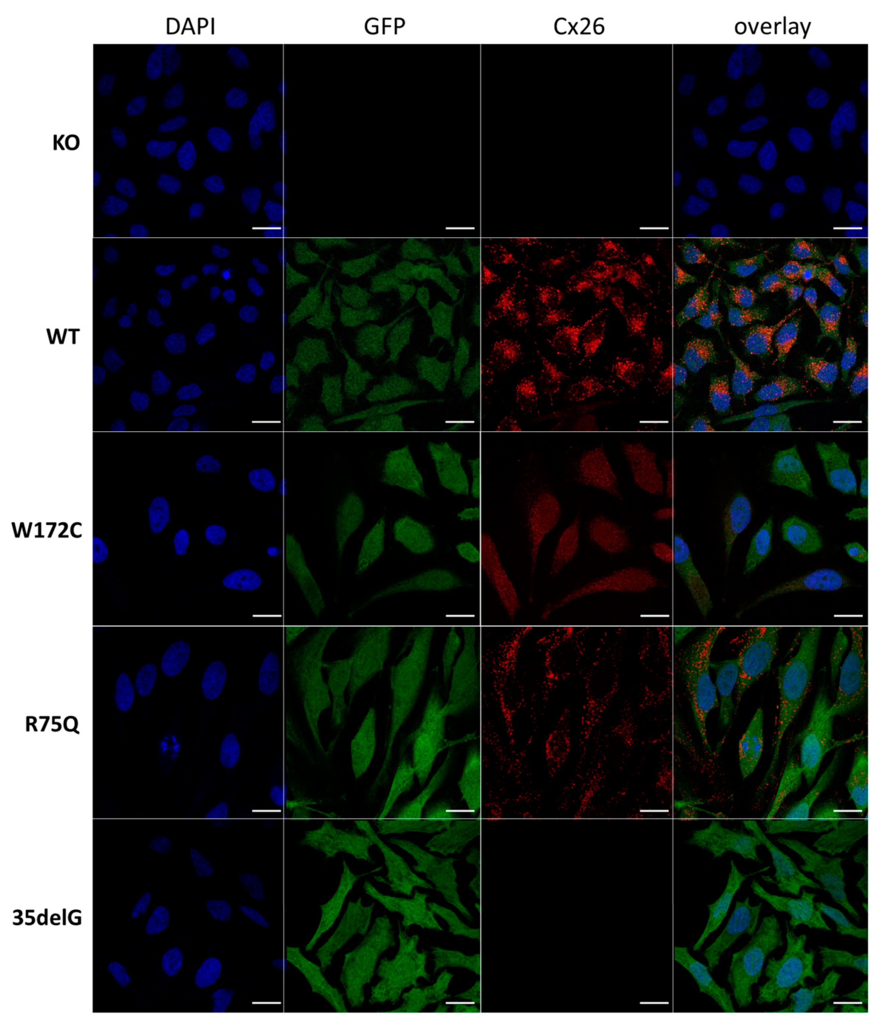 Functional Evaluation of a Rare Variant c.516G>C (p