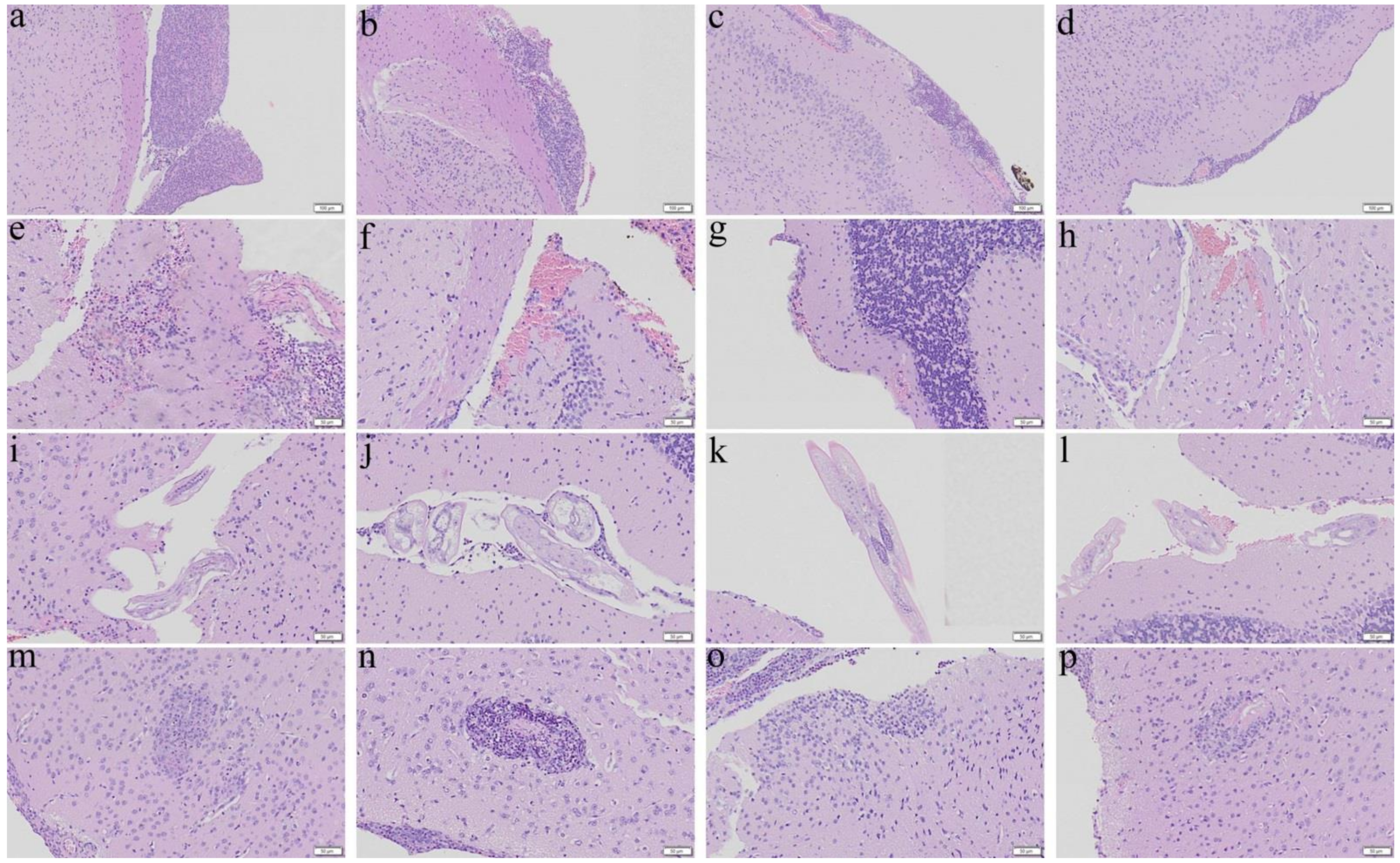 Biomolecules Free Full Text Co Therapy Of Albendazole And Dexamethasone Reduces Pathological Changes In The Cerebral Parenchyma Of Th 1 And Th 2 Dominant Mice Heavily Infected With Angiostrongylus Cantonensis Histopathological And Rna Seq Analyses Biomolecules Free Full Text Co Therapy Of Albendazole And Dexamethasone Reduces Pathological Changes In The Cerebral Parenchyma Of Th 1 And Th 2 Dominant Mice Heavily Infected With Angiostrongylus Cantonensis Histopathological And Rna Seq Analyses